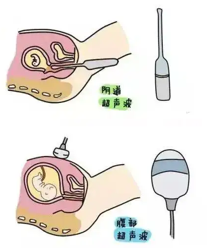 最好的代孕[广州精因宝贝靠谱吗],昆明第三代试管婴儿多少费用呀？