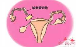 为了孩子子宫切除_纵膈子宫怀孕后_泰国试管婴儿必读九—我的精子都是畸形怎