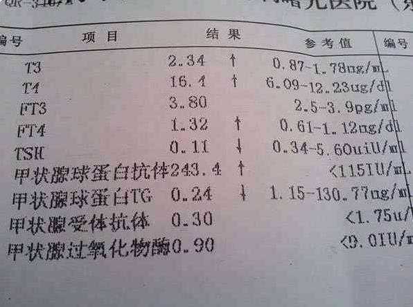 上海一般助孕的价钱 上海三代试管婴儿的条件和要求： ‘孕囊4.0×1.3是男孩还