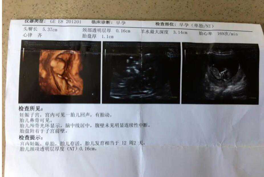杭州正规助孕生子 022年杭州能够进行供卵试管的医院名单，6家医院均有相关技
