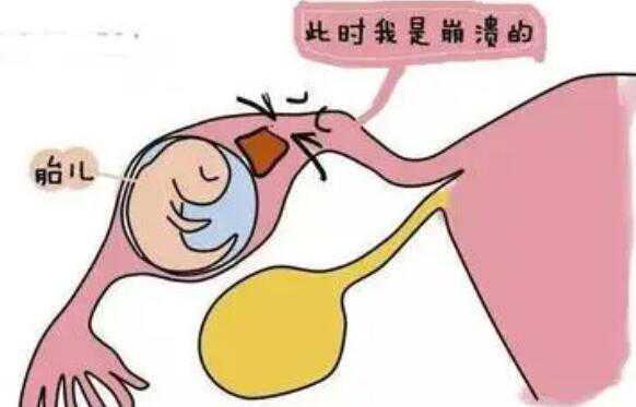 重庆试管助孕中心电话 重庆三代试管婴儿包生男孩医院排名，附试管生男孩条