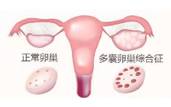 武汉365国际助孕中心_「昆明试管中心」女性不孕的早期症状有哪些?